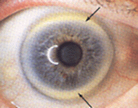 Iridology Blue Eyes - Dr Akilah El