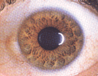 Iridiology with Brow eyes - Dr Akilah